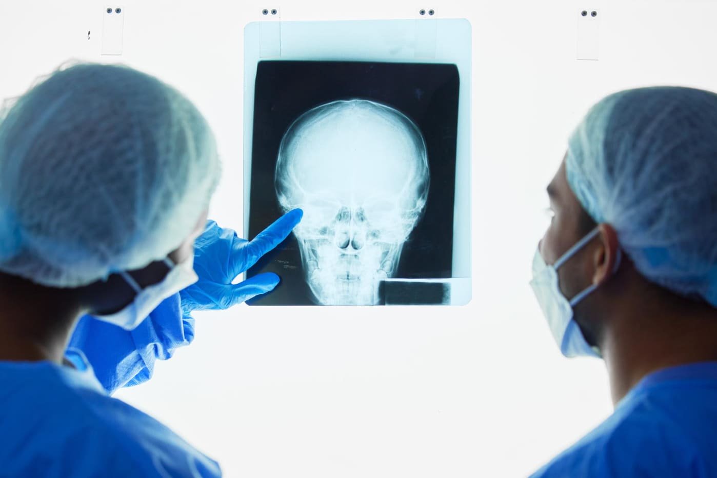 Craneoplastías en CDMX: Reconstrucción Craneal Avanzada con Neurocirugía Especializada